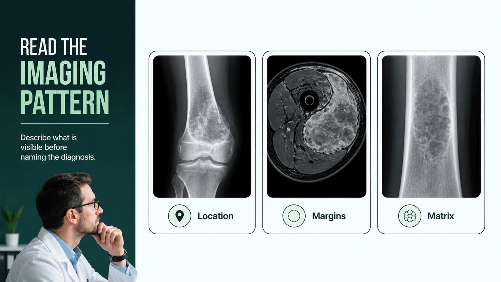 Bone cancer imaging presentation slide comparing radiographic observations in a structured blue and green layout.