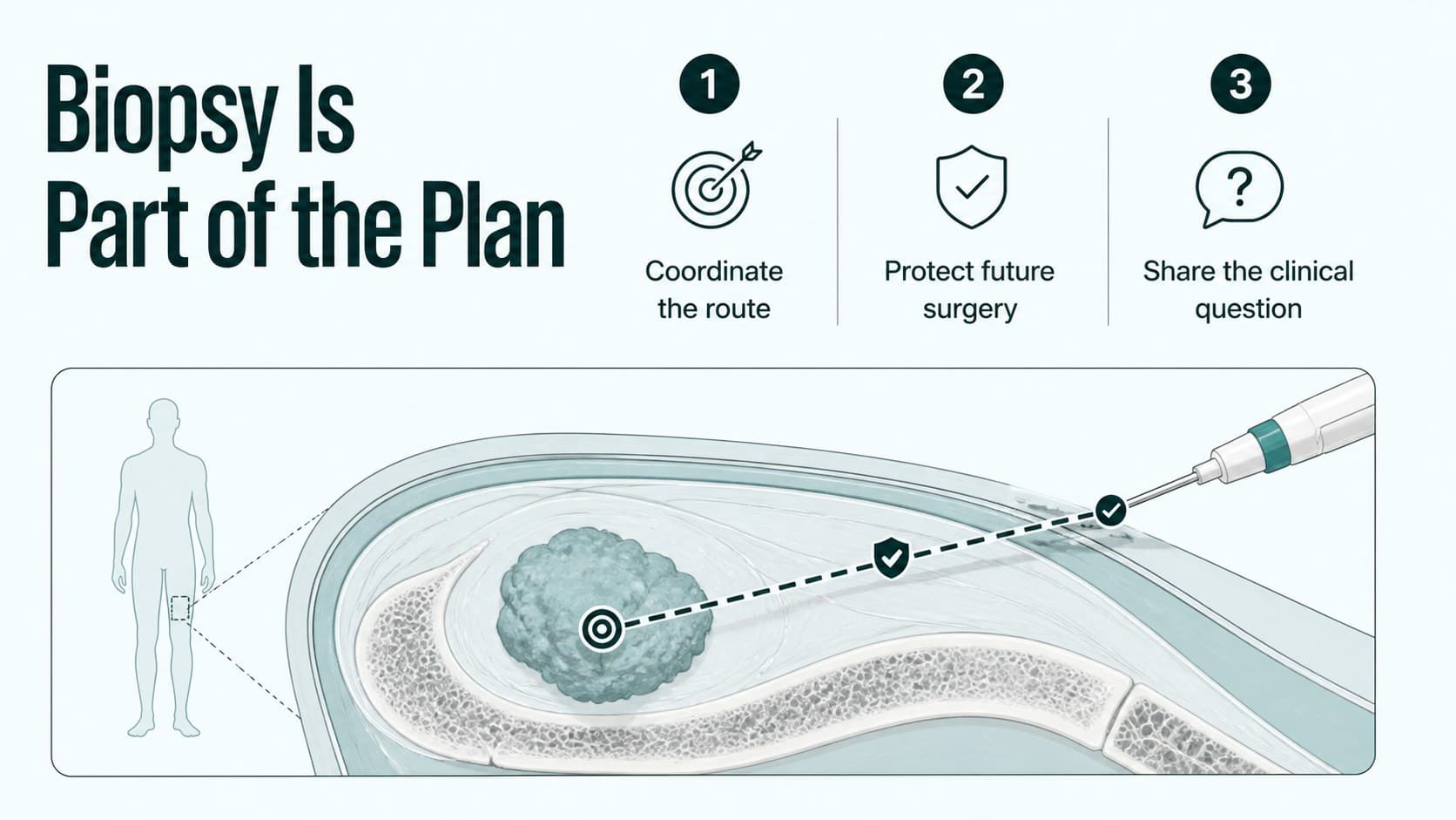 Orthopedic oncology lecture slide presenting biopsy planning principles beside a clean anatomical illustration.