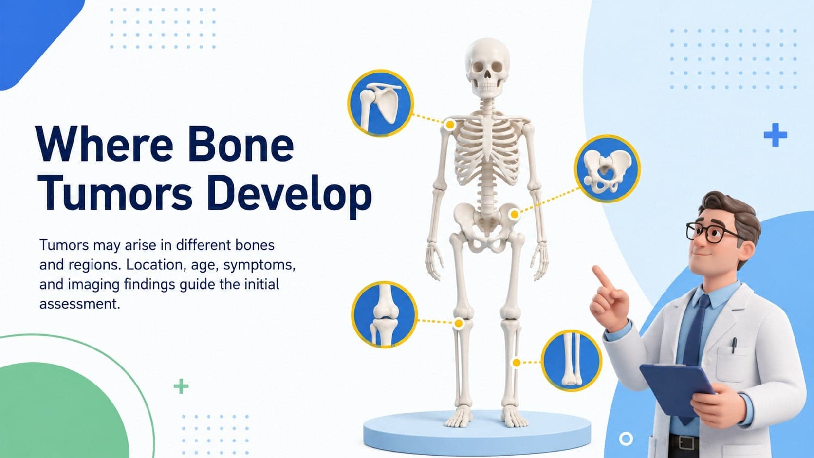Medical education slide mapping where bone tumors may develop across a simplified skeleton.