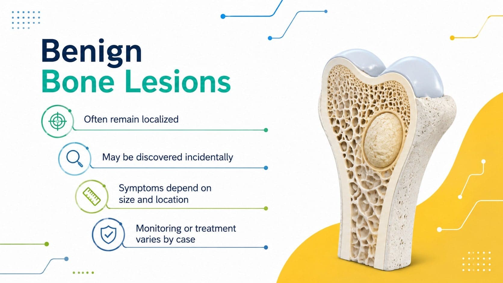 Benign bone lesion teaching slide with concise characteristics and a colorful 3D medical illustration.