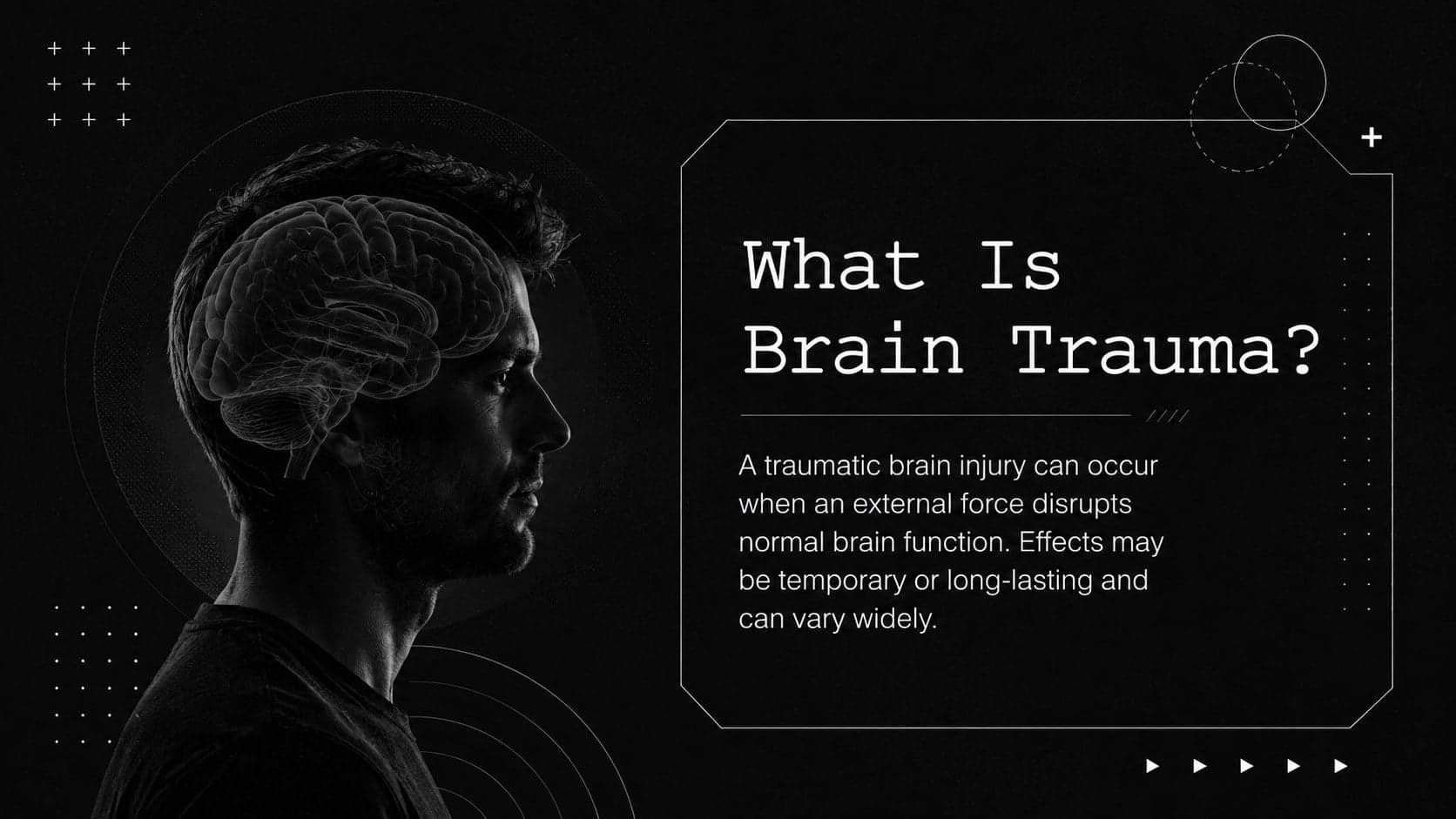 Traumatic brain injury overview slide defining external forces and changes in brain function.