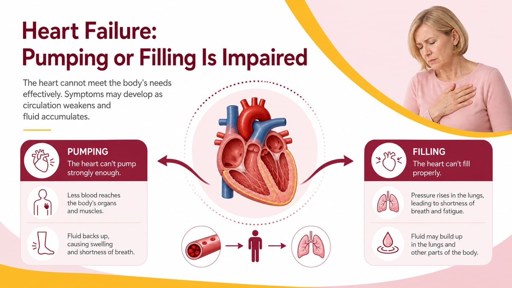 Heart failure lesson slide illustrating impaired filling or pumping and fluid buildup.