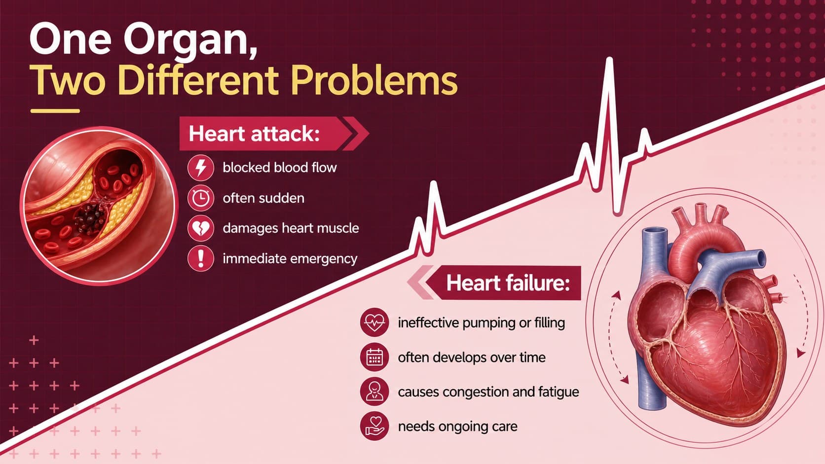 Heart attack versus heart failure chart comparing onset, mechanism, pattern, and urgency.