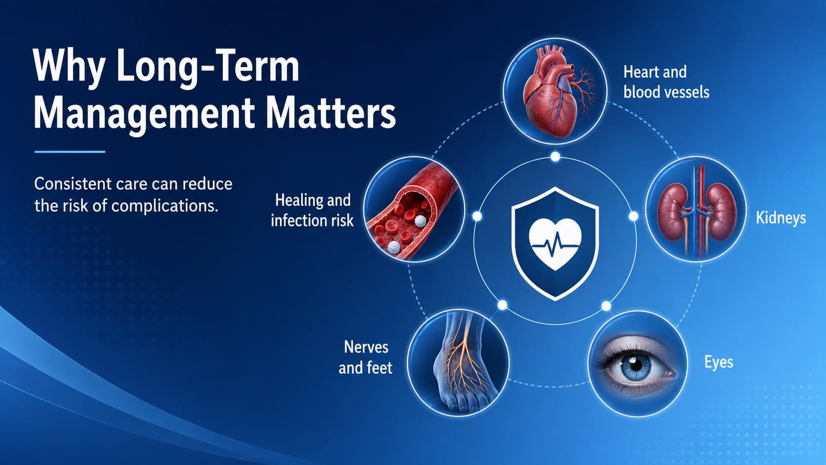 Modern blue type 2 diabetes slide mapping potential effects on the heart, kidneys, eyes, and nerves.