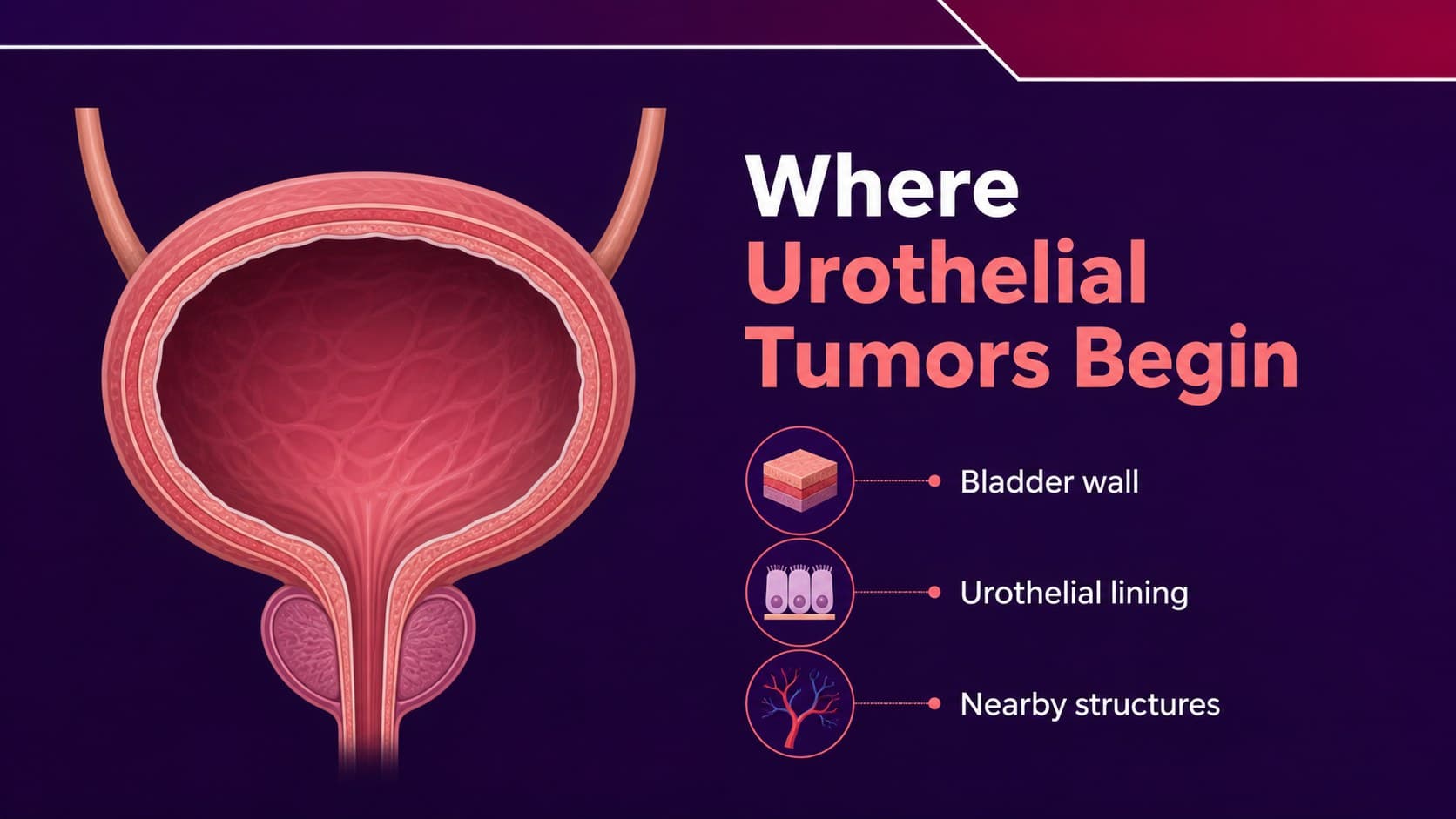 Anatomy diagram slide introducing the bladder and urothelial lining for medical education.
