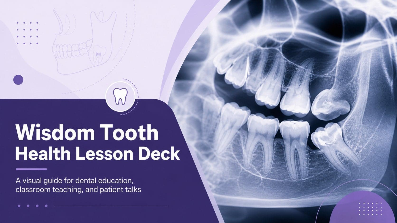 Cover slide for a wisdom tooth health lesson deck with a clinical dental photograph and purple educational styling.