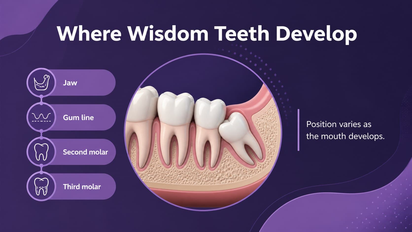 Dental anatomy slide labeling the jaw, molars, gums, and developing wisdom teeth.
